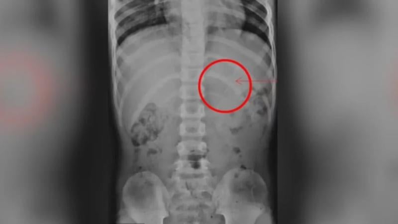 Niño se come lápiz Niño se come lápiz