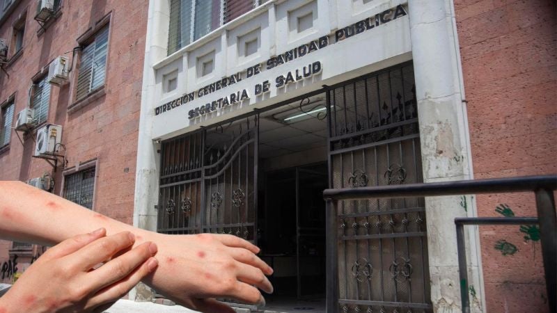 Alerta por viruela del mono en Honduras Alerta por viruela del mono en Honduras