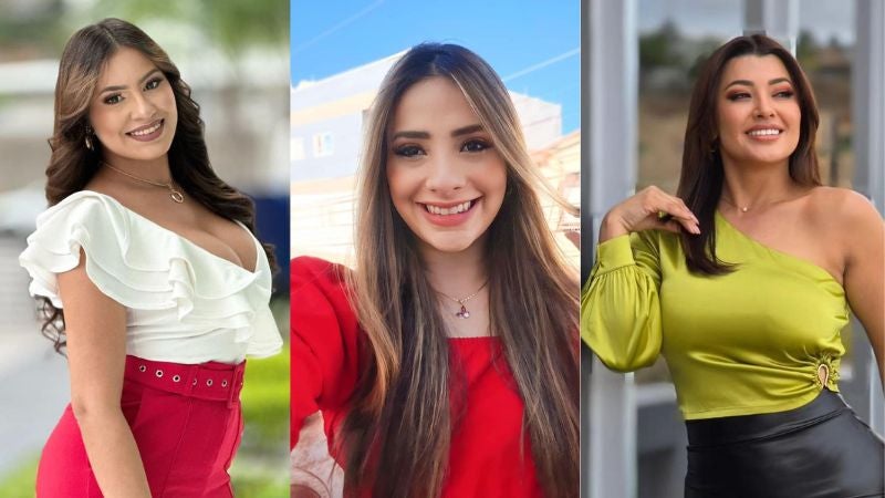 Presentadoras revelan retoques estéticos Presentadoras revelan retoques estéticos