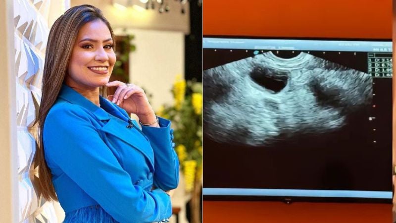 Alejandra Rubio embarazada Alejandra Rubio embarazada