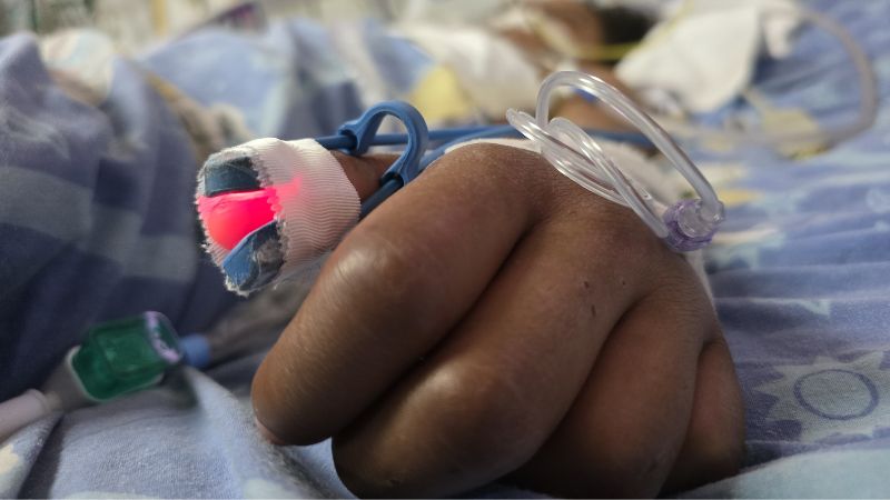 Masajes empacho niños UCI Masajes empacho niños UCI