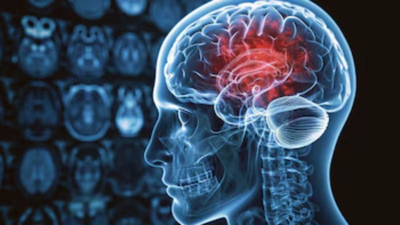 alcohol cerebro