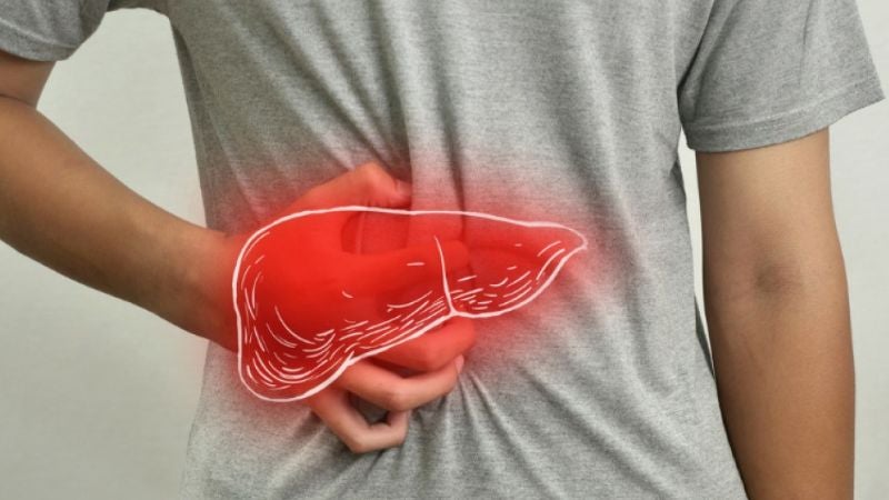 Cómo prevenir el hígado graso: hábitos clave para proteger tu salud hepática