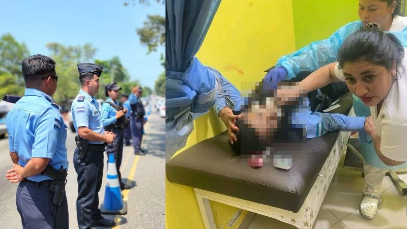 Policía herido en Santa Bárbara