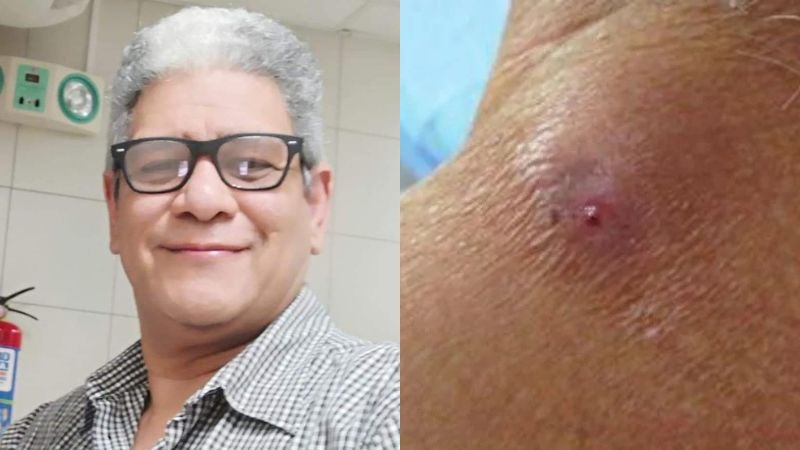 Gusano barrenador Médico cuestiona protocolos de la Sesal