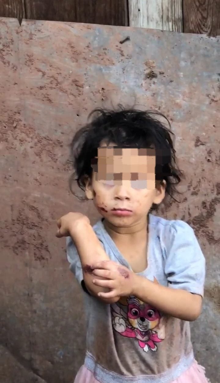 Denuncian a joven castigos inhumanos hacia sus hijas