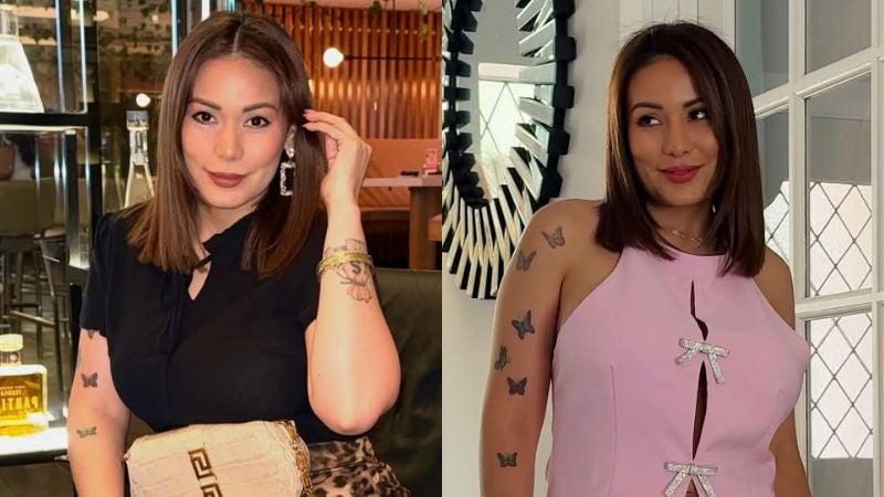 Elsa Oseguera cirugía estética