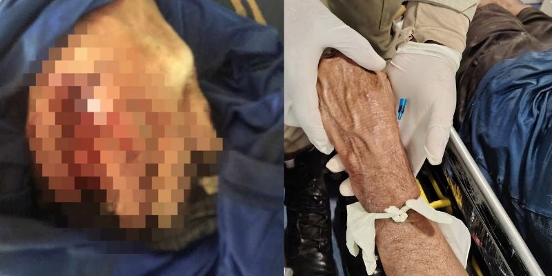 Pescador en Atlántida casi pierde la mano tras ataque de lagarto