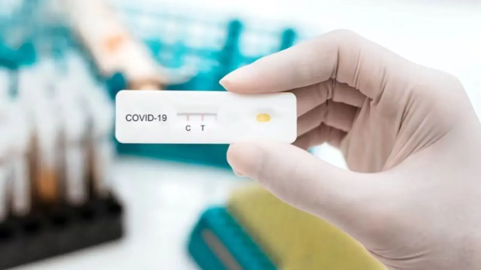 IHSS pruebas para COVID-19