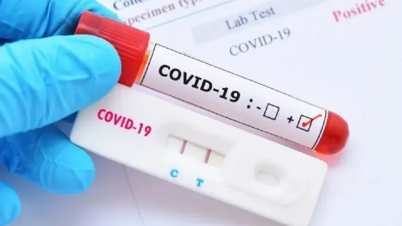 Covid-19 Honduras Médicos hondureños advierten sobre un brote de Covid-19 en el país