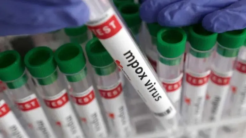 Viruela símica en Honduras