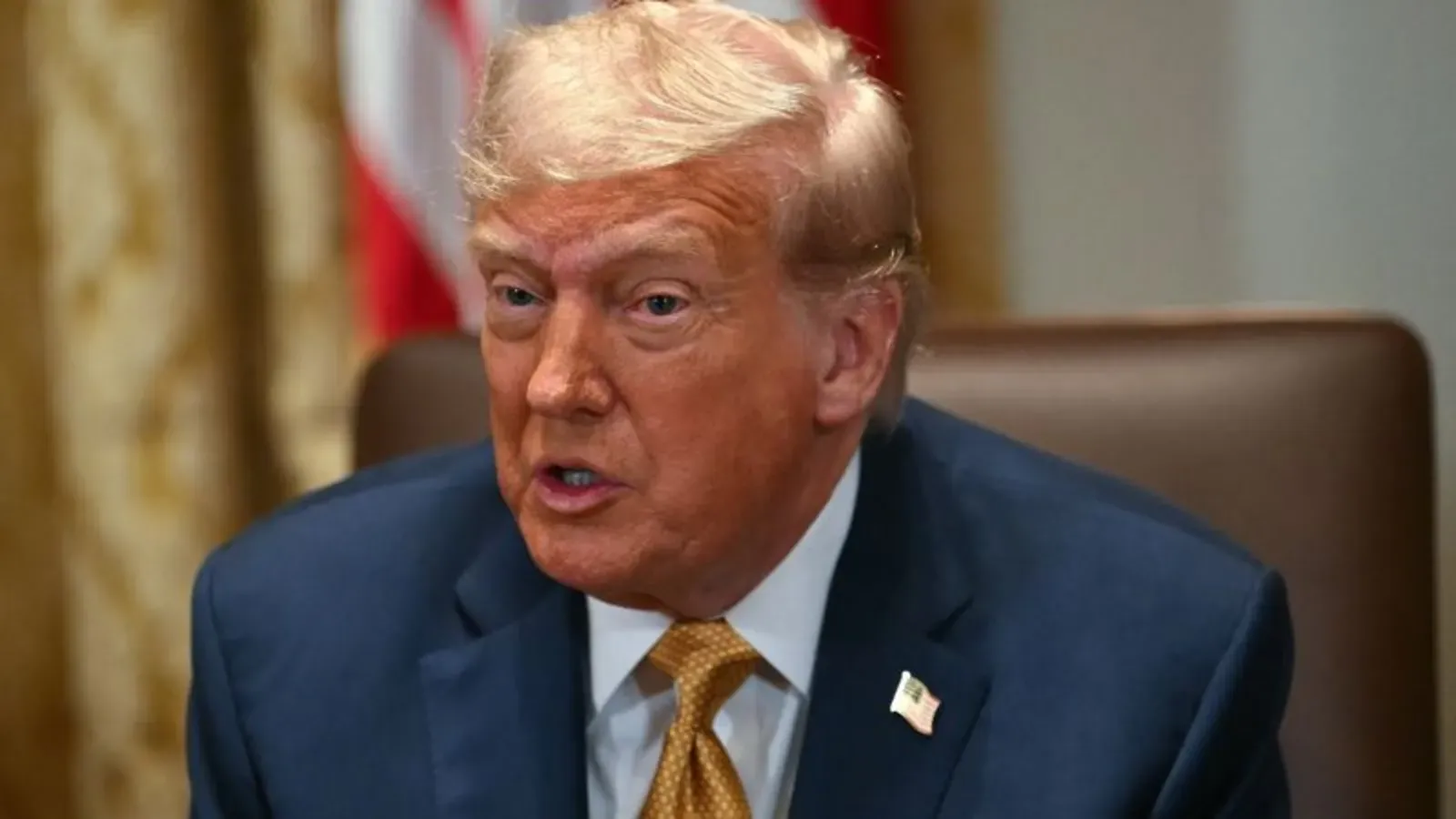 Donald Trump insuficiencia venosa crónica