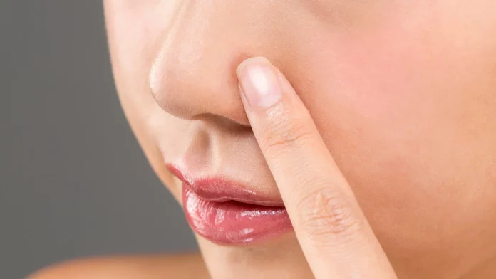 Por qué sangra la nariz