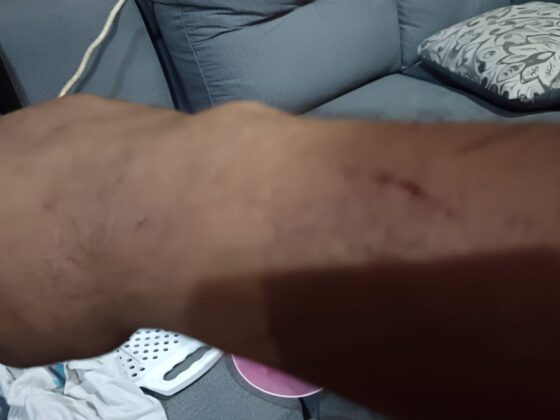 violencia desalojo Koriun