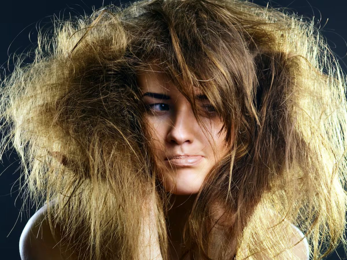 cuesta peinarte el cabello síndrome