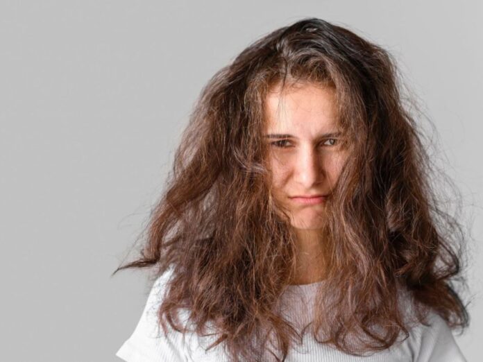 cuesta peinarte el cabello síndrome