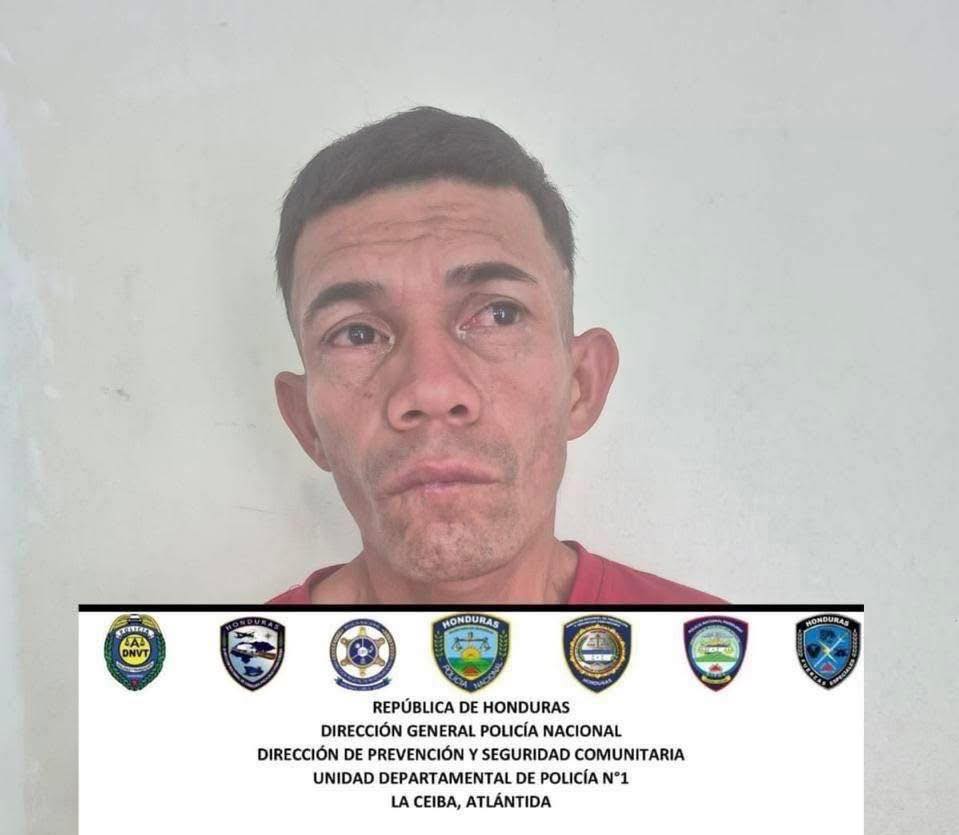 Hombre golpeó guardia