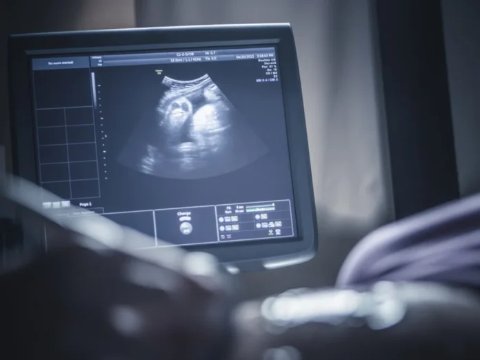 mujer embarazada nueve bebés