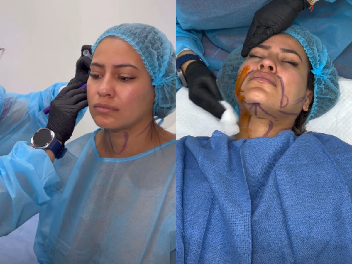 Alejandra Rubio revela el costo de su nueva cirugía estética