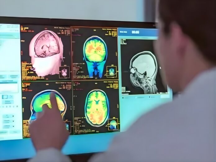 Estudio revela que adolescencia dura hasta los 32 años