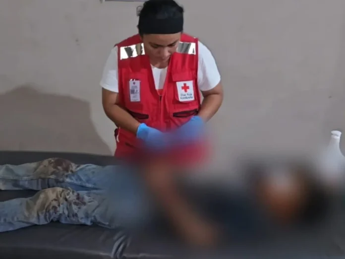 Niño de 11 años sufre graves heridas tras brutal ataque de perro sabueso en Copán