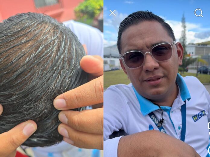 Periodista de HCH denuncia agreciones por simpatizantes de Libre durante una concentracion