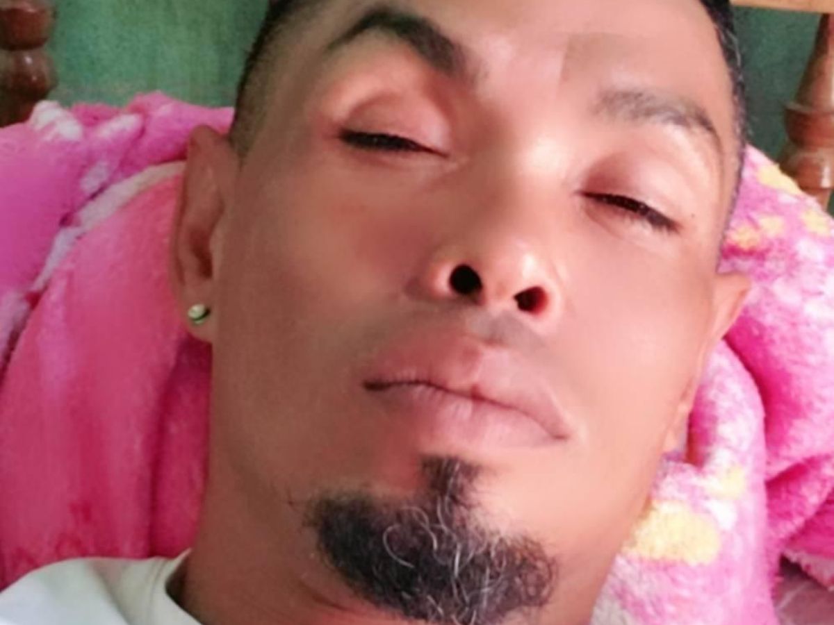 Muere hombre tras discusión política en Choluteca (1)