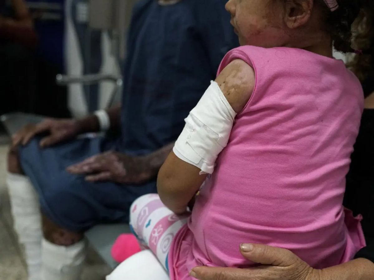 Más de 450 menores han sido atendidos por quemaduras en lo que va de 2025
