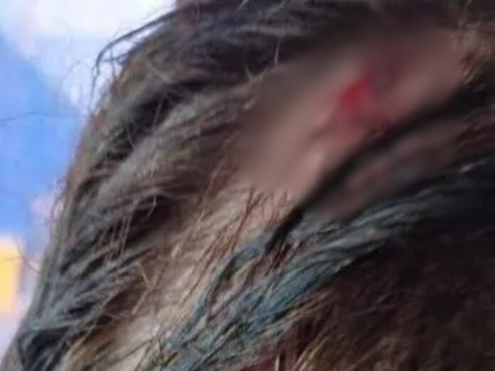 Pastores agredidos CNE iNFOP