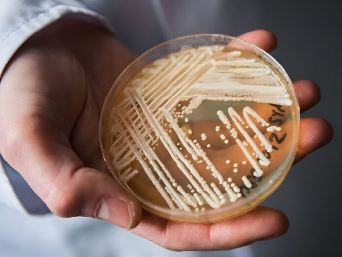 alerta-hongo-mortal-estados-unidos